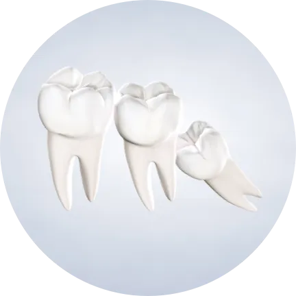 Homepage procedure wisdom teeth 2