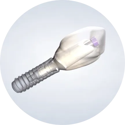 Homepage proceduredental implant 2