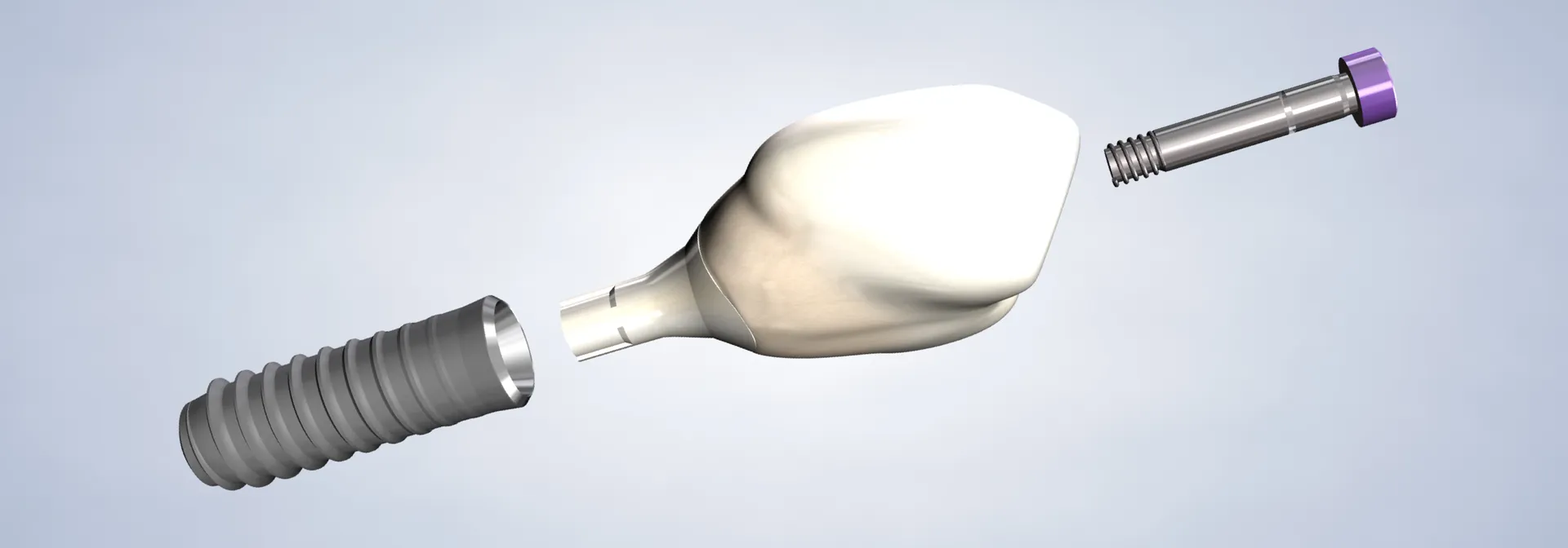 Dental Implants in Walnut Creek, CA