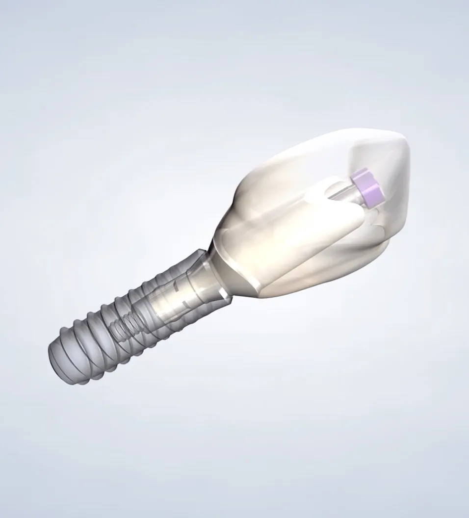Dental Implants in Walnut Creek, CA