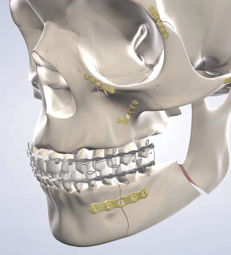 Facial Trauma Treatment in Walnut Creek, CA