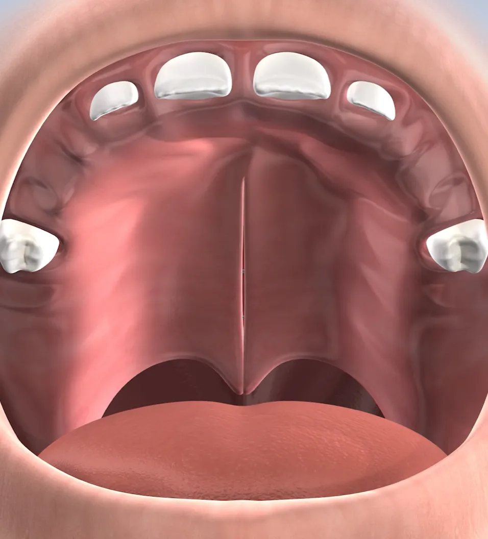 Procedure query page cleft lip and cleft palate