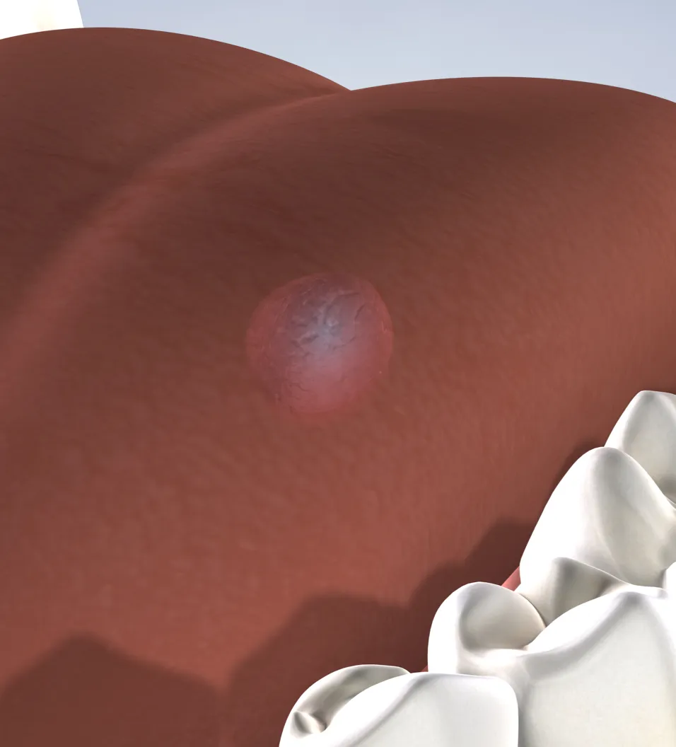 Oral Pathology in Walnut Creek, CA